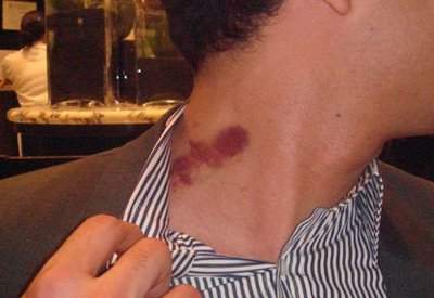 Scratch marks, Bite marks, or Hickies keeps me smiling cause I know that my boyfriend gave me them but no one else knows that a gay man gave another man marks.